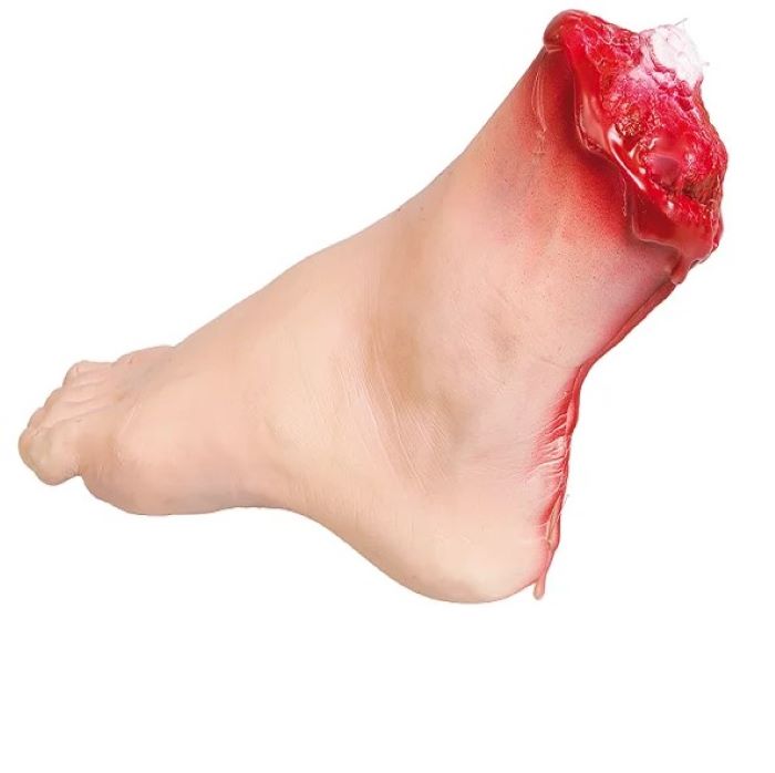 Billede af Afhugget blodig fod